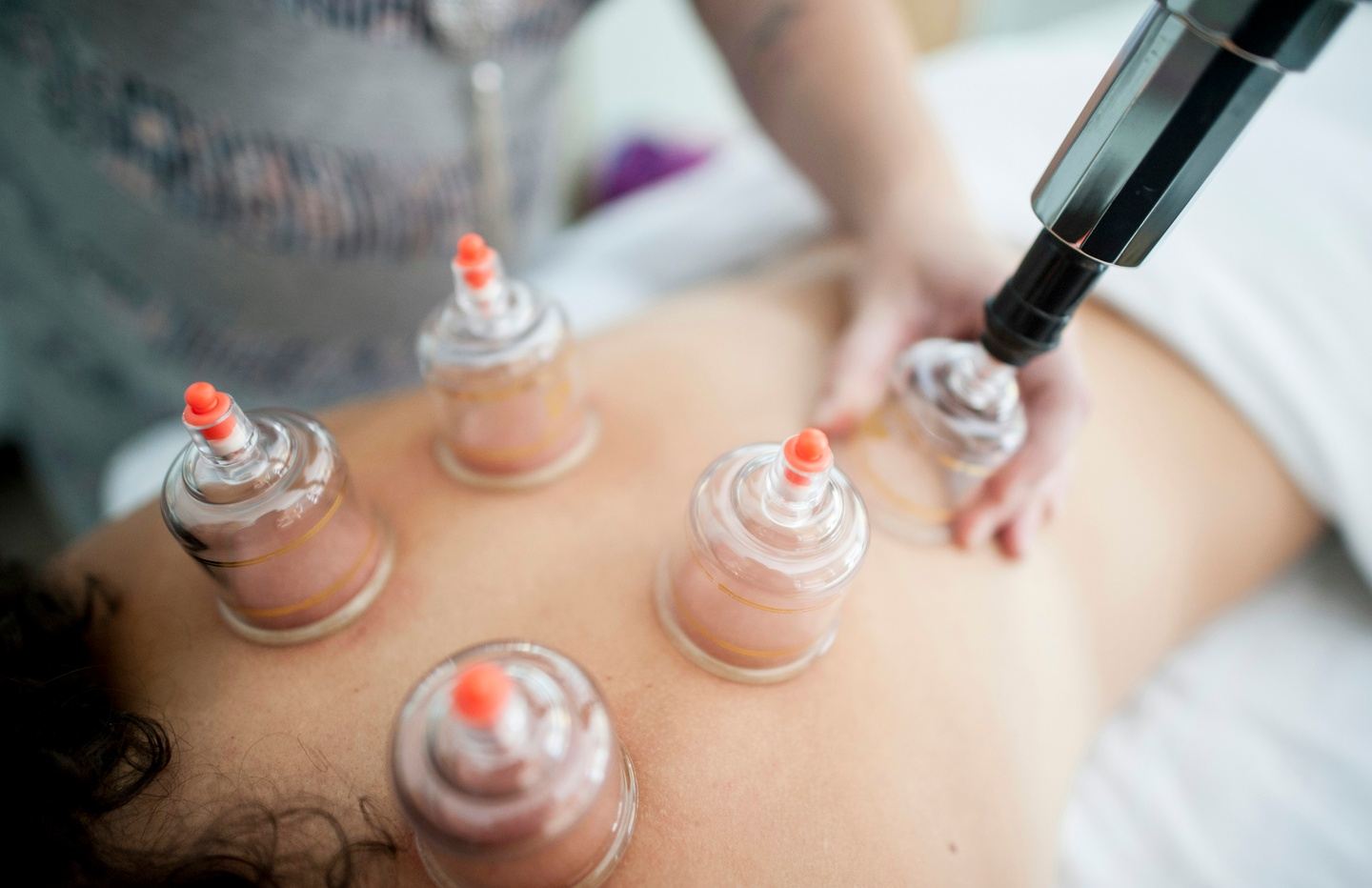 Myofascial Cupping,  Gua Sha & Kinesiotaping